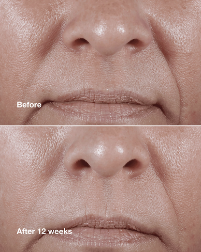 Clinique Smart Clinical Repair™ Wrinkle Correcting Rich Cream - US 8826