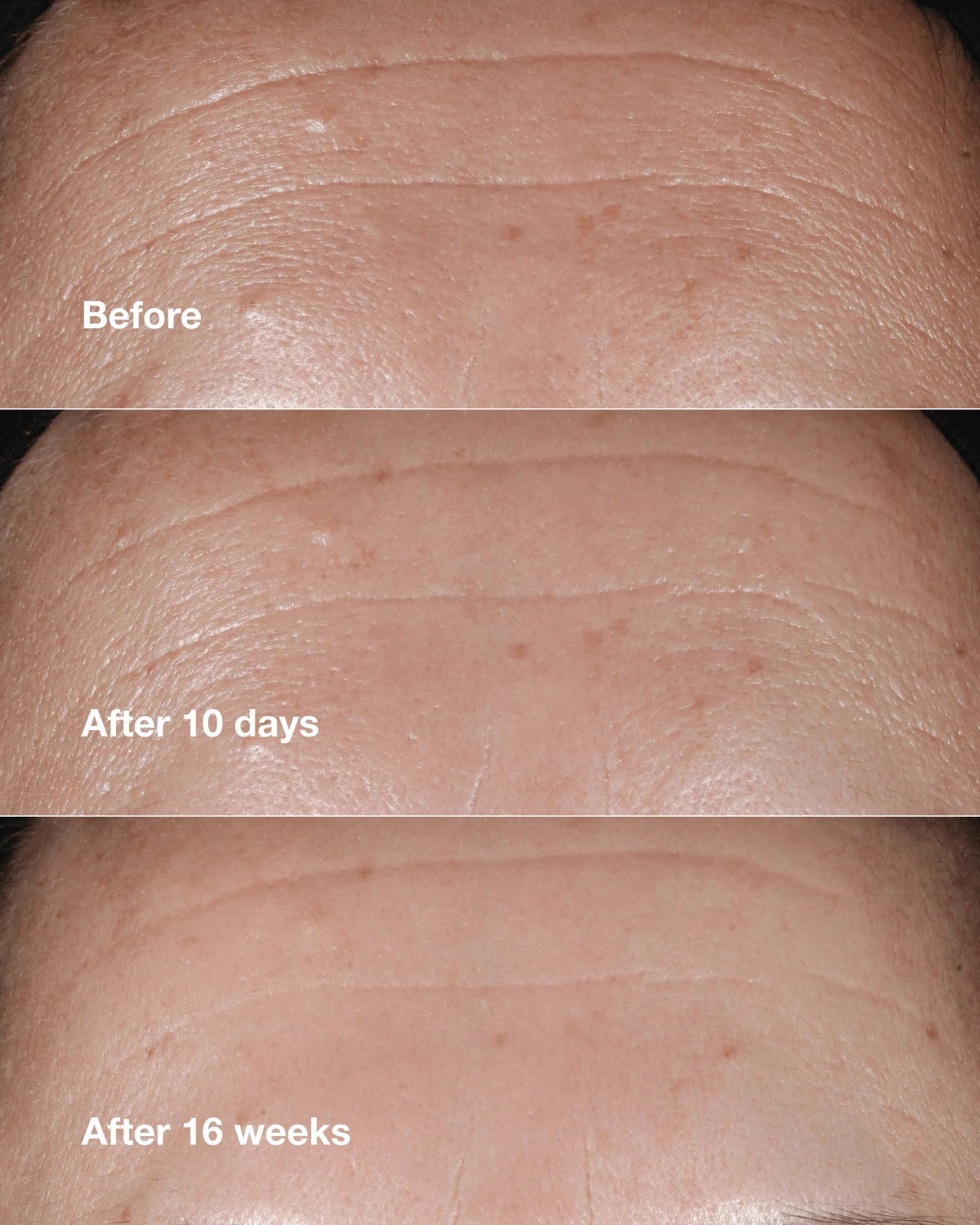 Anti-Aging Routine: Mini Smart Clinical Repair Kit - US 3094