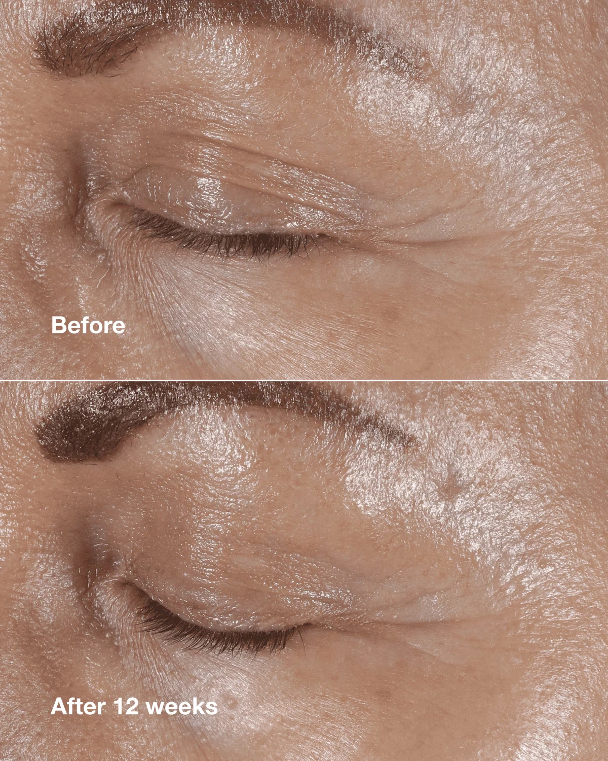 Anti-Aging Routine: Mini Smart Clinical Repair Kit - US 3094