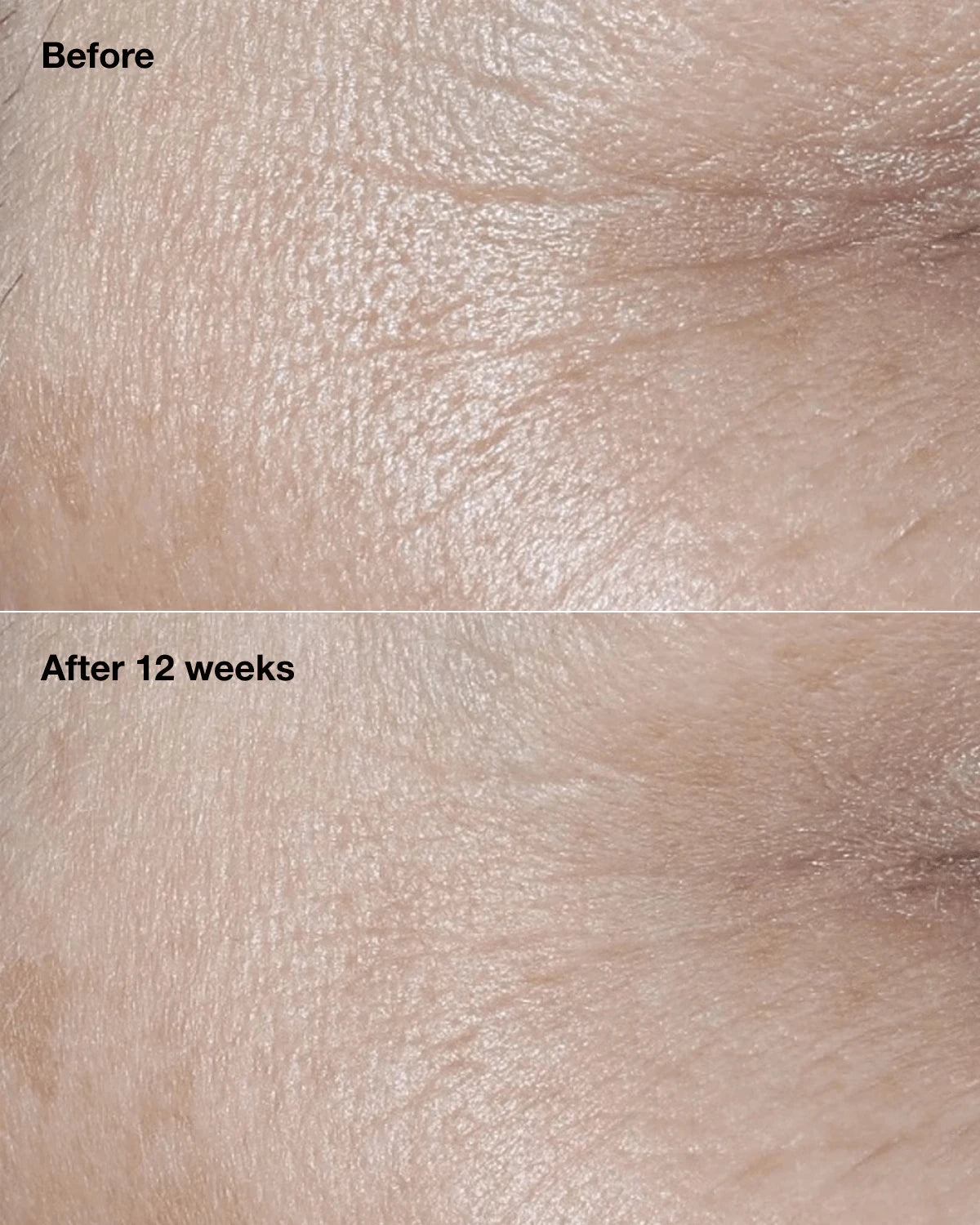 Clinique Smart Clinical Repair™ Broad Spectrum SPF 30 Wrinkle Correcting Cream - US 0562