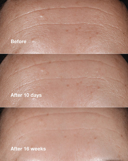Clinique Smart Clinical Repair™ Wrinkle Correcting Serum - US 8116