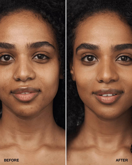 Even Better Clinical™ Serum Foundation Broad Spectrum SPF 25 - US 2599